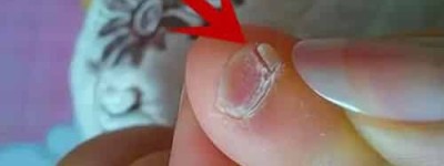 小拇指甲两瓣是正宗汉人吗，小脚趾甲两瓣是哪族人_稗官野史 菊江历史网