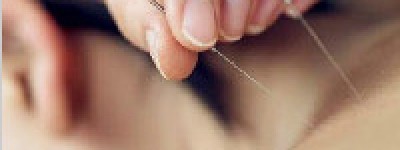 中医针灸有什么理论？中医针灸的方式_民间艺术 菊江历史网