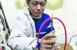 胡颂文【自助透析13年的尿毒症患者】 – 人物百科