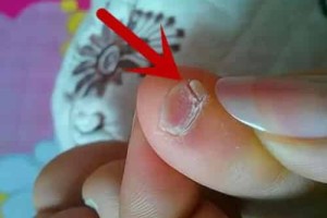 小拇指甲两瓣是正宗汉人吗，小脚趾甲两瓣是哪族人_稗官野史 菊江历史网